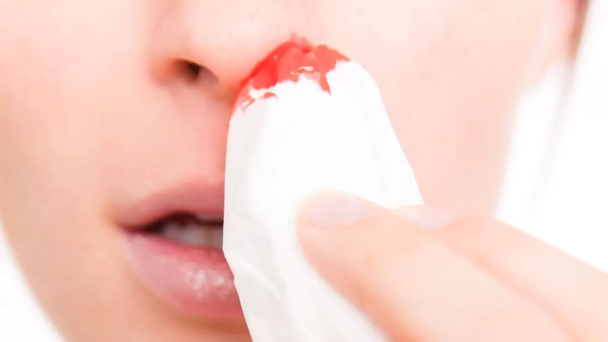 De ce curge sânge din nas?